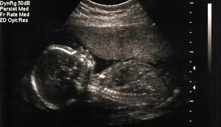 Texas lawmakers passed a bill last year that banned 