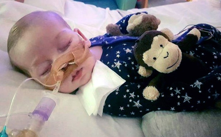 Charlie Gard was born in October with encephalomyopathic mitochondrial DNA depletion syndrome, or MDDS. It has left him crippled and with brain damage. He depends on a ventilator to keep him alive. (Family handout/PA Wire)