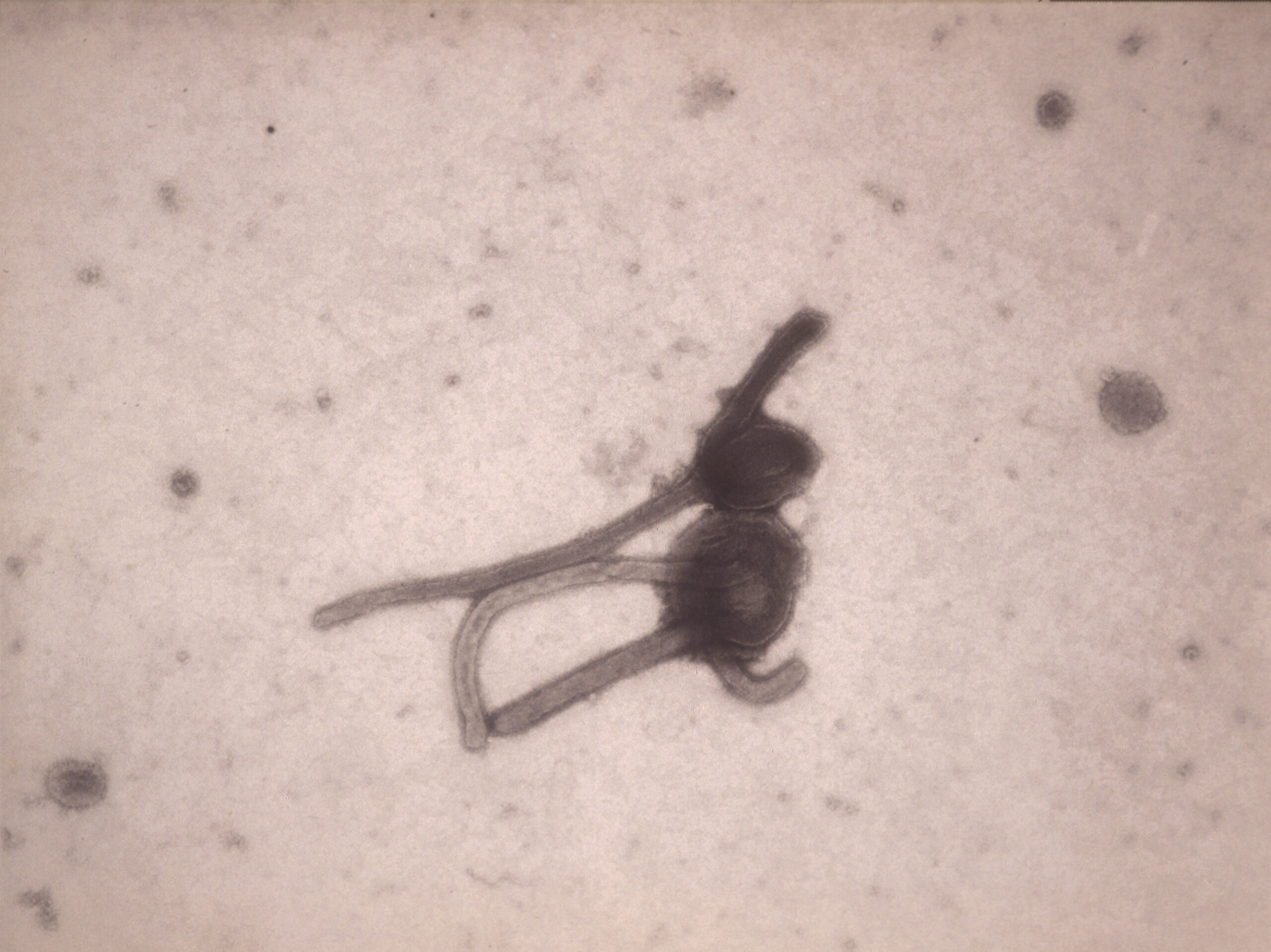 UN: Ebola outbreak a public health emergency