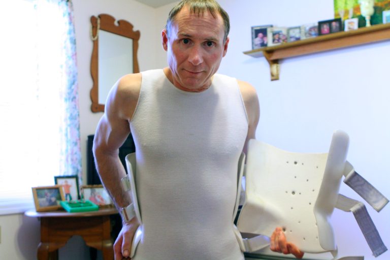 In this April 1, 2014 photo, Ernie Merritt stands with his back brace at his home in of Saco, Maine. Merritt, who runs a support group for chronic pain patients, supports Medicaid guidelines that promote alternative treatments, including physical therapy, in place of narcotic painkillers. Maine is leading in efforts to stem the flow of powerful opioid painkillers with unique Medicaid guidelines. (AP Photo/Blake Davis)
