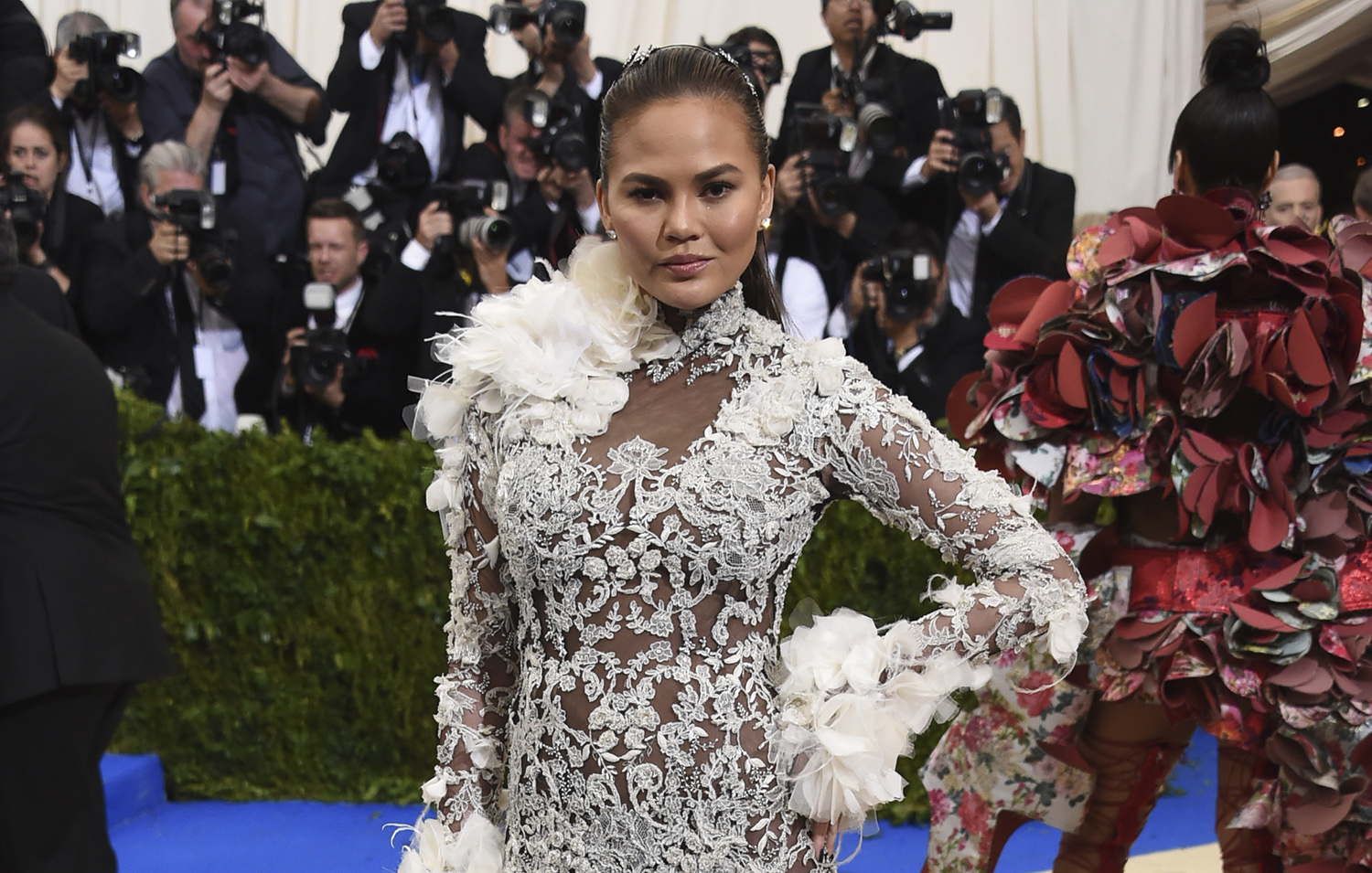 Model Chrissy Teigen says Trump should pay for her botox, medical bills because of ‘crippling anxiety’