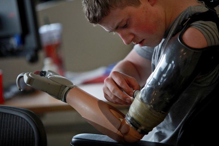 Army Pfc. Kevin Trimble, 19, adjusts his myoelectric upper limb prosthetic for occupational therapy at the Center for the Intrepid at Brooke Army Medical Center in San Antonio. At 19, Kevin has lost both legs above the knee and an arm from a bomb in Afghanistan. (AP Photo)
