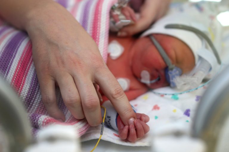 As medical advancements improve prospects for premature babies, viability becomes a shifting standard. (Getty Images)