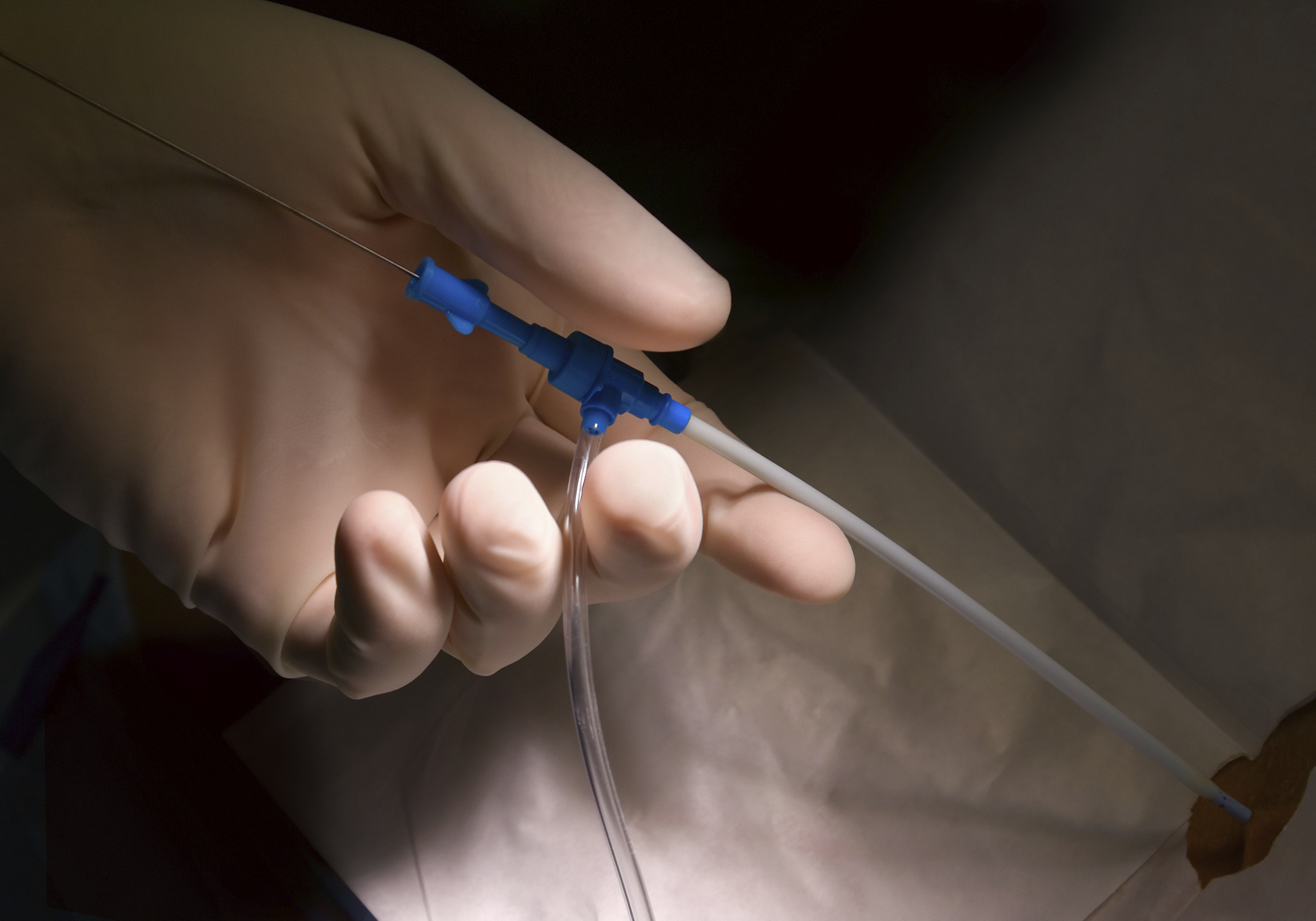 Ending medical device tax: A win for K Street, a loss for Tea Party
