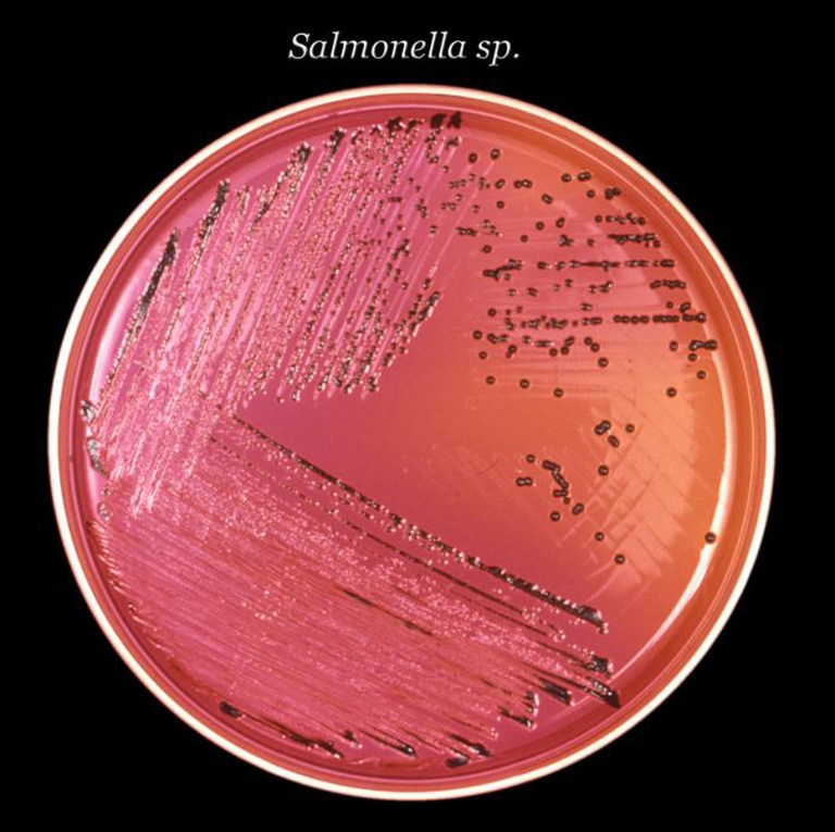   This undated image provided by the Centers for Disease Control and Prevention (CDC) shows Salmonella bacteria in a petri dish. It's about to get faster and easier to diagnose food poisoning _ but that progress for individual patients comes with a downside: It could hurt the nation's ability to spot and solve dangerous outbreaks. Next-generation tests that promise to shave a few days off the time needed to tell if E. coli, salmonella or other foodborne bacteria are to blame for a patient's illness could reach medical laboratories as early as next year.(AP Photo/CDC)  