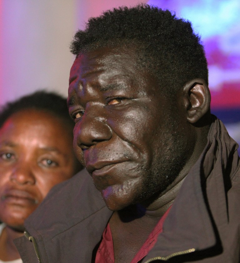   In this photo taken Tuesday, May 29, 2012, William Masvinu, winner of the Mr Ugly competition poses for a photo with his wife Alice at a local club in Harare. Masvinu, 38, who won the second edition of the pageant last month, makes his living carrying loads for shoppers in a market in the impoverished western Harare township of Mbare. The victory has made him a local celebrity, but the modelling offers he thought heâd be getting arenât yet pouring in. (AP Photo/Tsvangirayi Mukwazhi, file)  