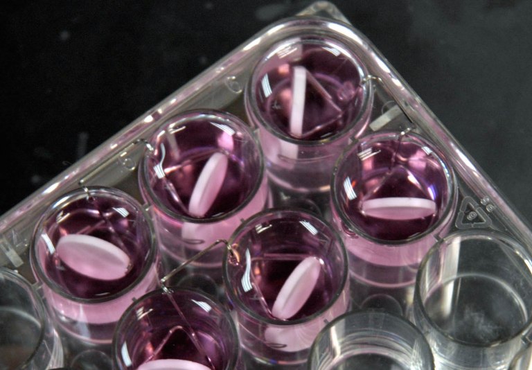 A study published in aÂ medical journal looked at the increase of antibiotic resistance in infections from the 10 most common surgical procedures.Â (AP Photo/Kevin Rivoli)