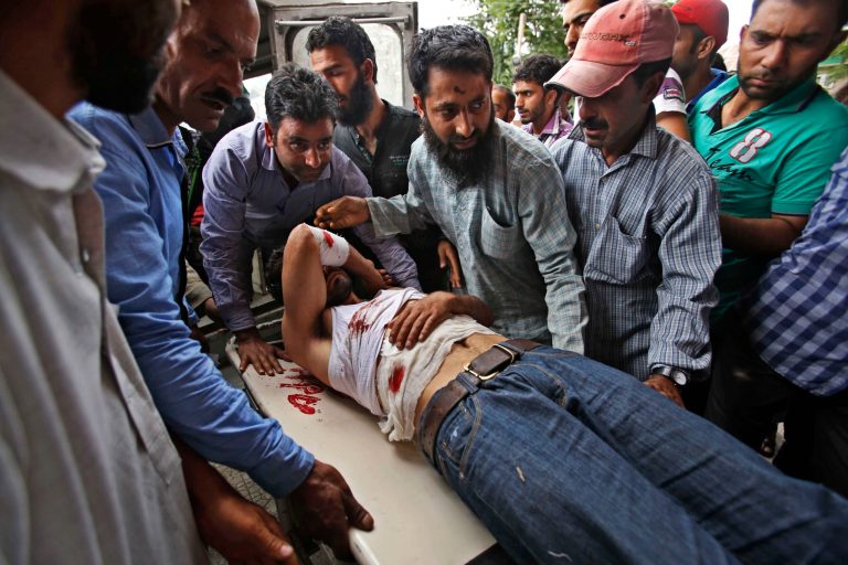 A Kashmiri man, is brought for treatment at a hospital in Srinagar, India after he was injured in firing by Indian troops during a protest in Sopore, about 55 kilometers (34 miles) northwest of here, Monday, June 23, 2014. A protester was killed and four others were wounded Monday when Indian government forces in Kashmir fired at demonstrators protesting the killing of a suspected rebel in an earlier gunbattle, police said. (AP Photo/Mukhtar Khan)