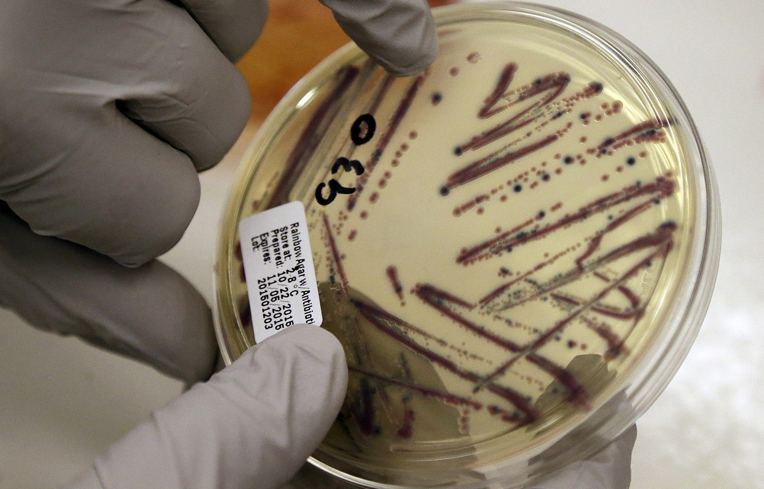 Deadly superbug found in U.S.