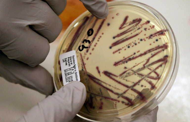 The superbug strain of the bacteria E. coli was found in a 49-year-old woman in Pennsylvania. (AP Photo/Elaine Thompson, File)