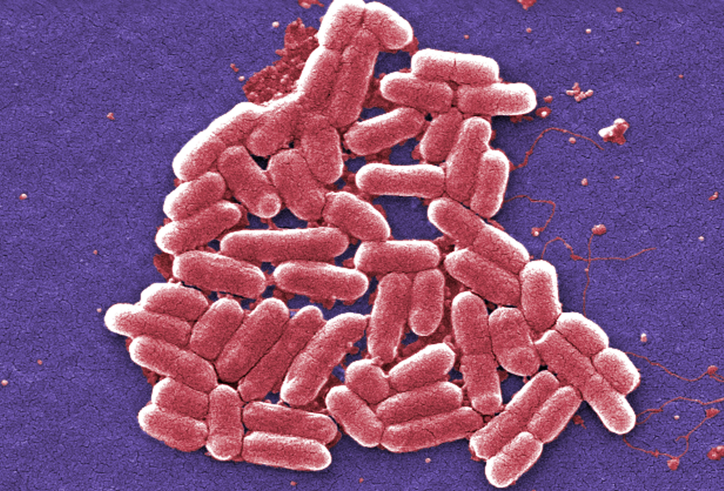 Feds move to contain deadly superbug