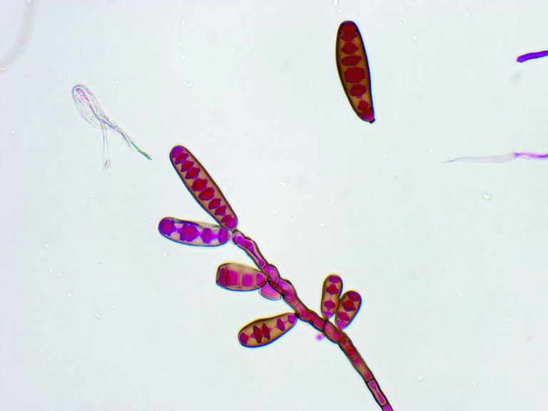 This undated image made available by The Centers for Disease Control and Prevention shows the Exserohilum rostratum fungus. The CDC said Thursday, Oct. 11, 2012 tests have shown Exserohilum fungus in 10 people sickened in the current fungal meningitis outbreak. It's a common mold found in soil and on plants. (AP Photo/CDC)