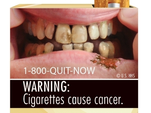 CDC wants more cigarette taxes, regs as tobacco usage flattens, teens experiment