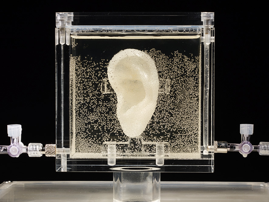German museum shows live replica of van Gogh’s ear