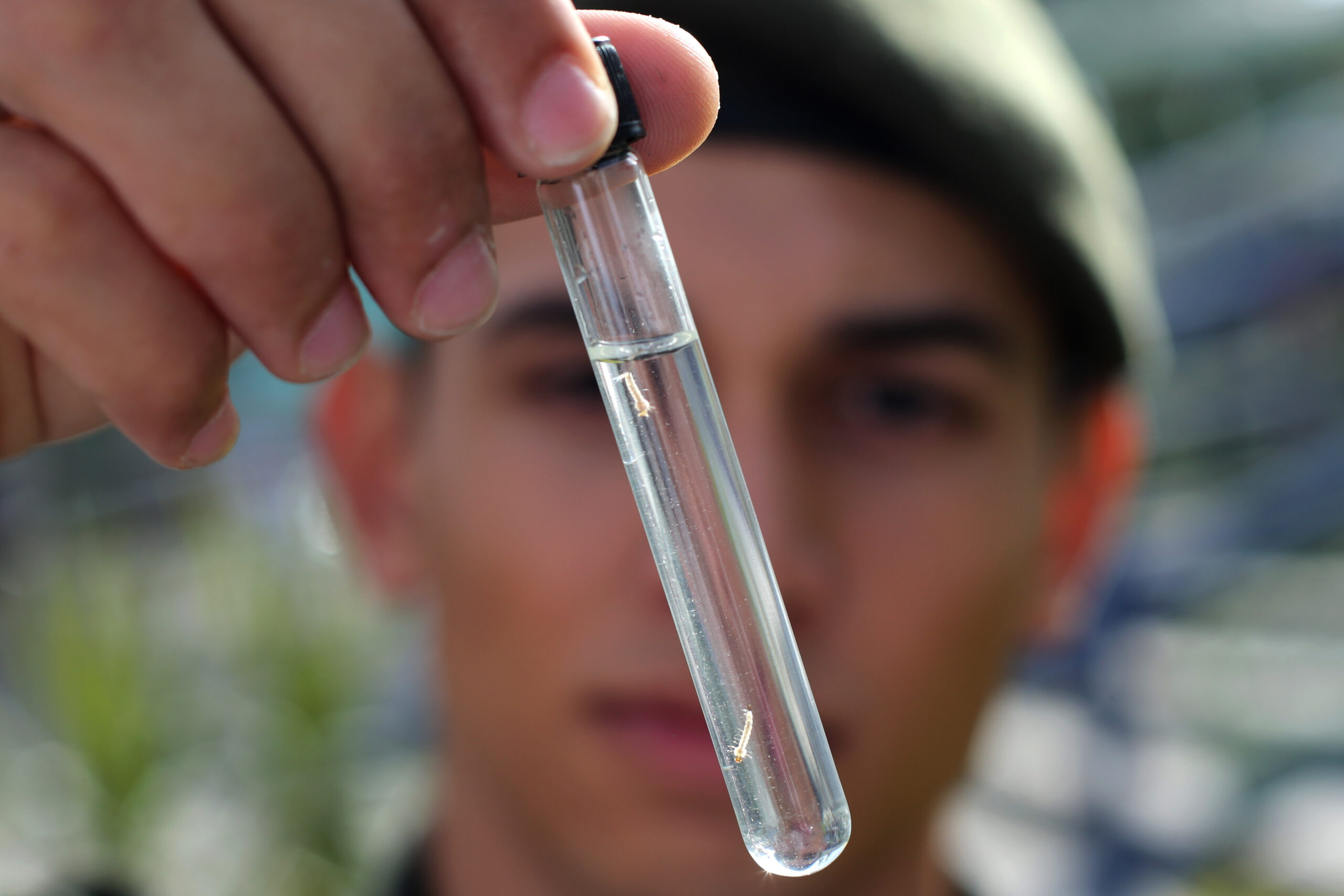 WHO: Vaccines don’t cause Zika-related birth defect