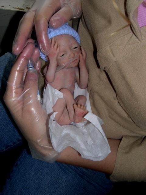 Inside the late-term abortion industry