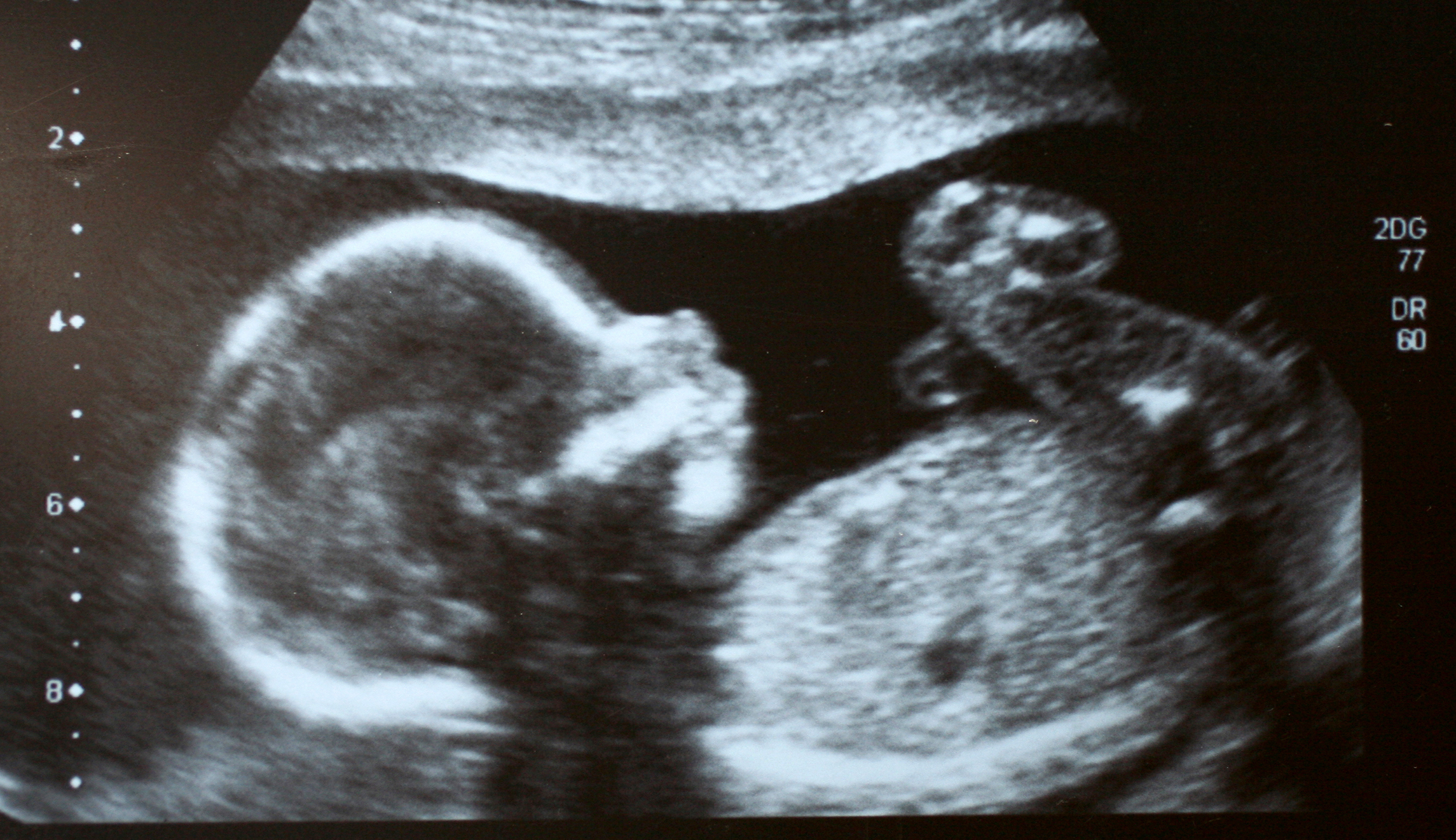 Nevada legislature passes abortion protections