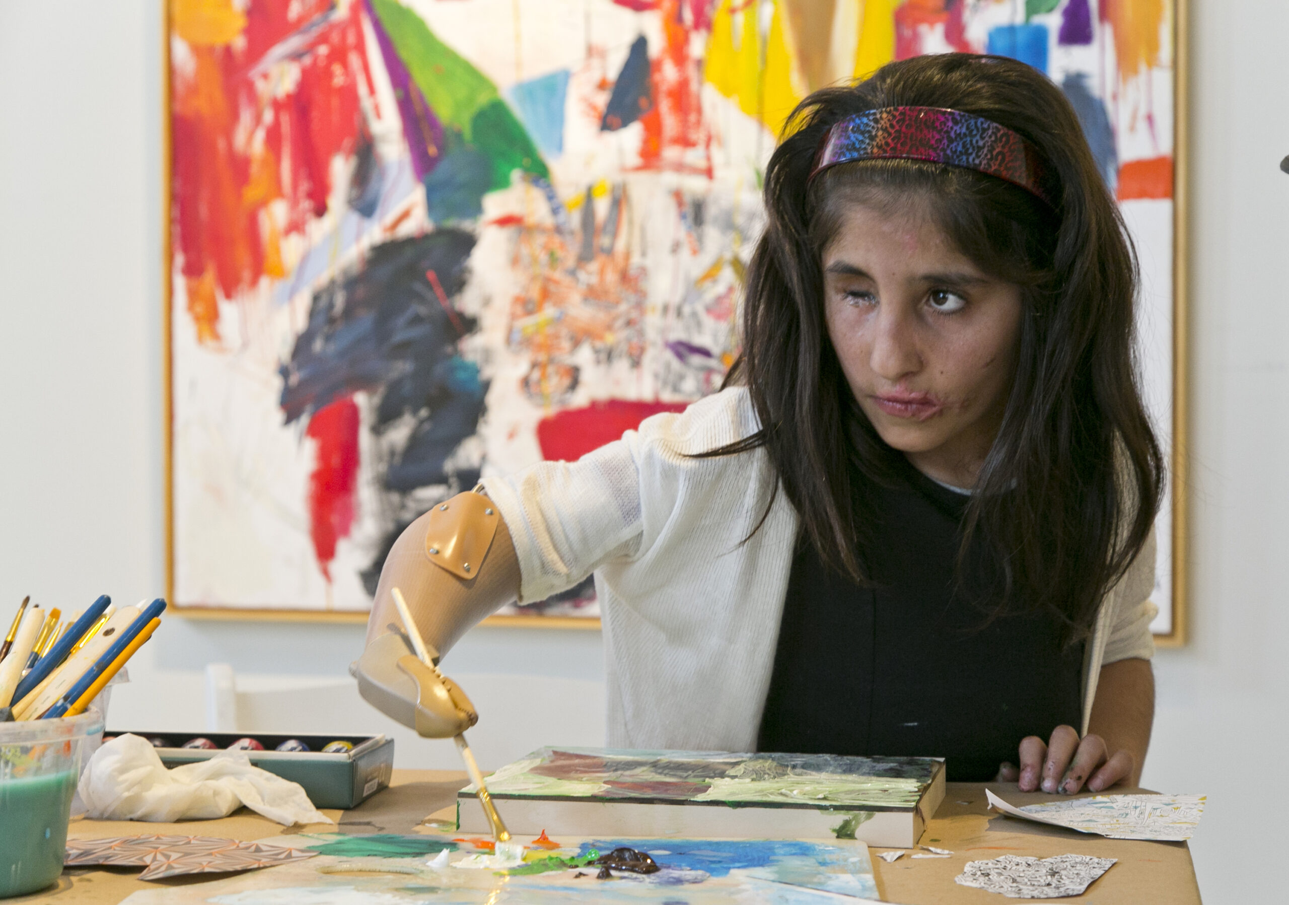 Afghan girl who lost arm paints with prosthetic