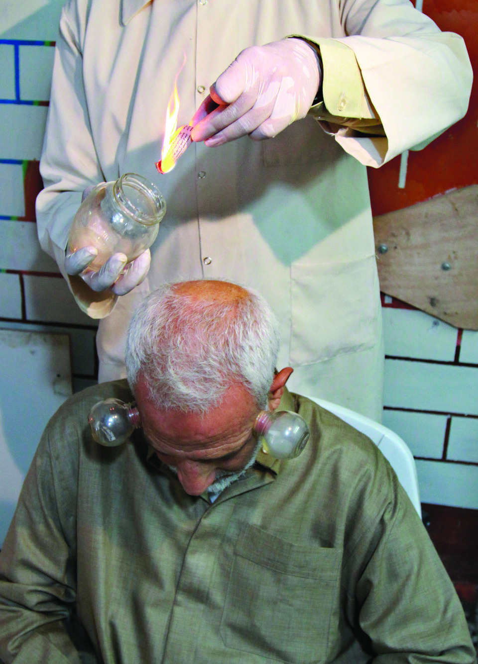 Traditional Gaza drawn to old alternative therapy
