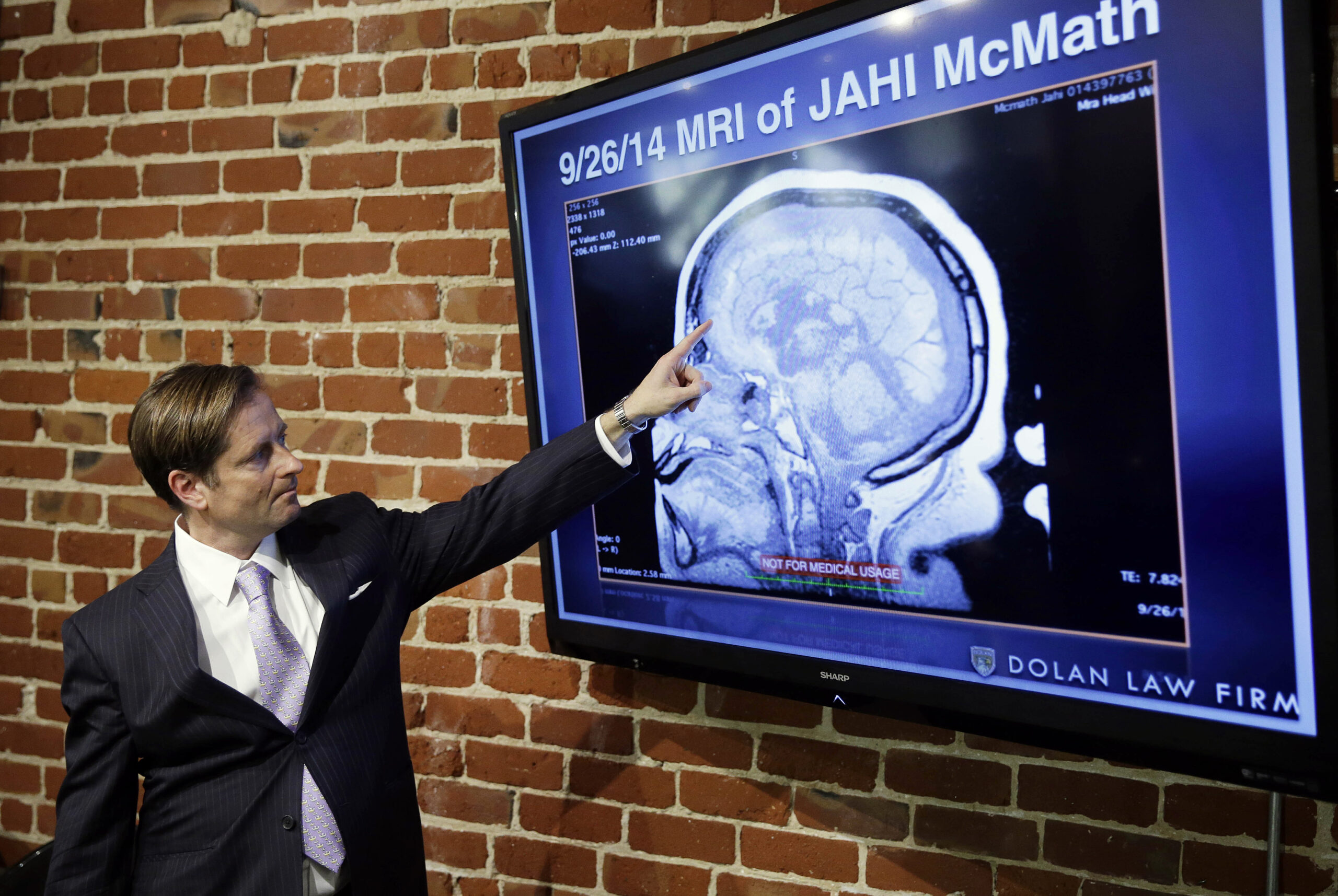 All life matters: Jahi McMath’s journey