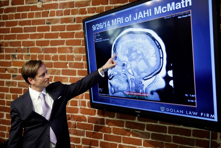 Attorney Christopher Dolan points to a recent MRI of Jahi McMath during a news conference at his law office Oct. 3, 2014, in San Francisco. Debate over the definition of 