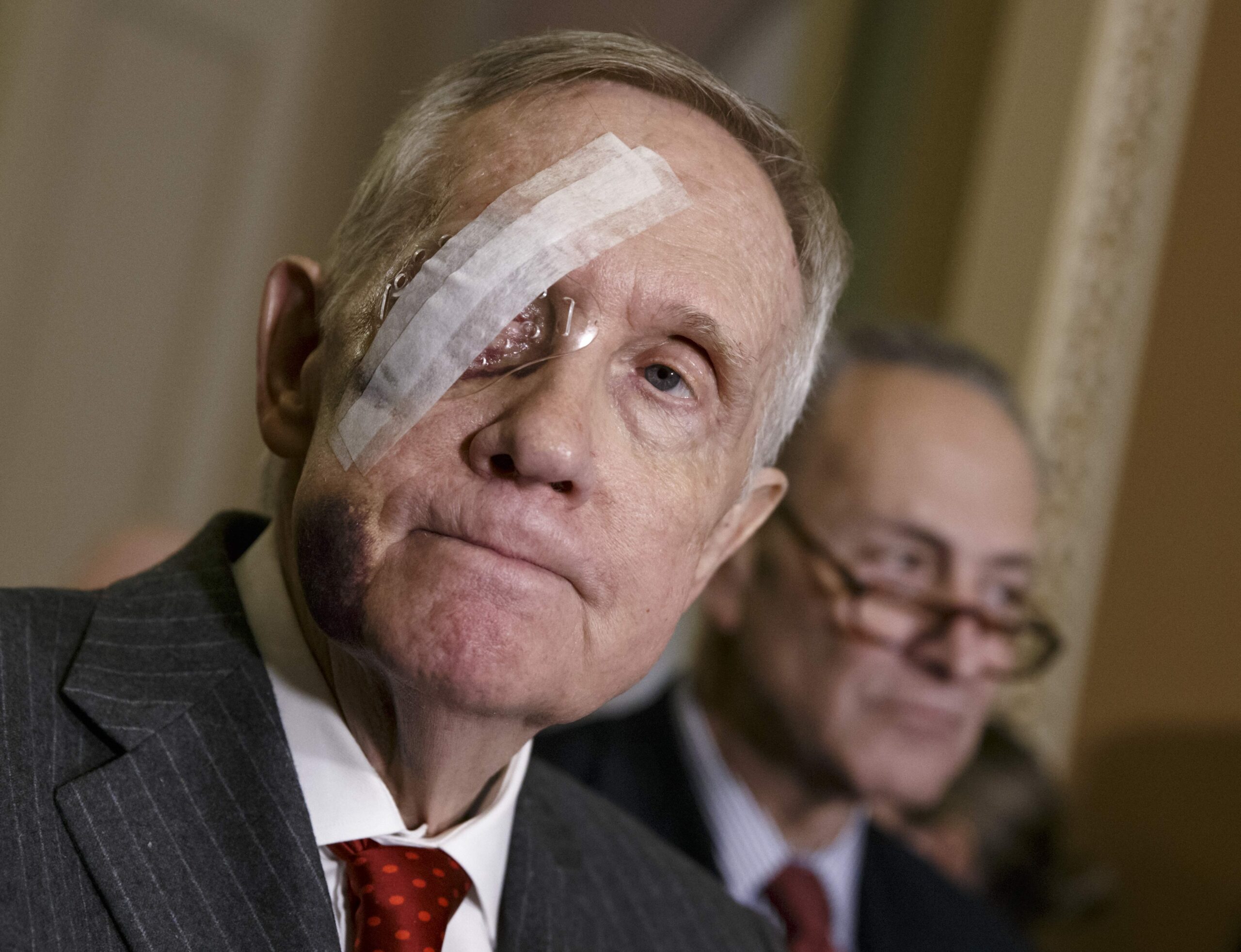 Reid sues exercise band company over eye injury