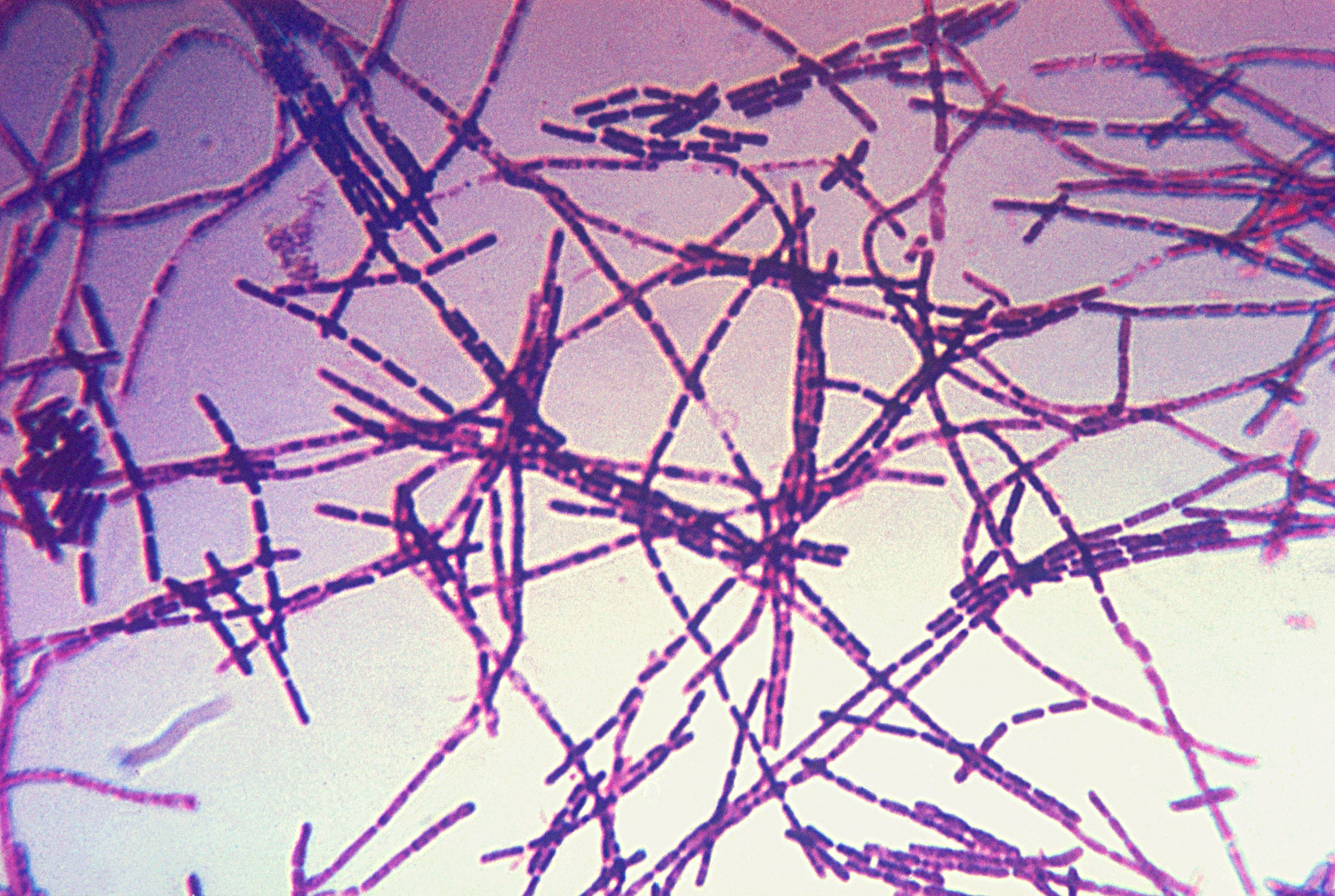 Pentagon, CDC search for answers after anthrax foul-up