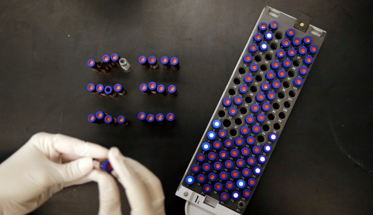 Christine Jelinek, a postdoctoral fellow at Johns Hopkins University, works alongside a tray of vials containing cerebral spinal fluid in Baltimore on Aug. 10, 2015.