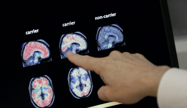 brain scans