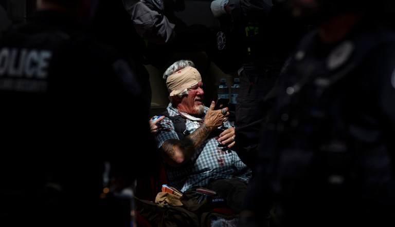 A man checks his phone while surrounded by police and medics after being injured during a civil disturbance in Portland, Ore., on Saturday. Competing demonstrations, including members of the so-called Proud Boys and anti-fascist groups, spilled into the streets of downtown Portland, with fights breaking out in places as marchers clashed. 