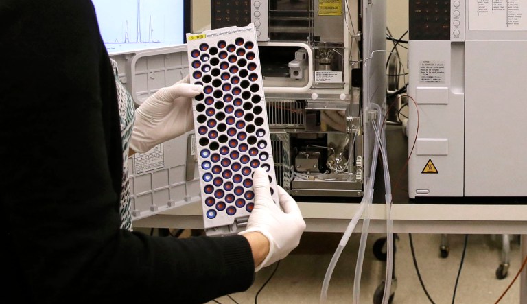 In this Aug. 10, 2015, photo, Christine Jelinek, a postdoctoral fellow at Johns Hopkins University, prepares to load a tray of vials containing cerebral spinal fluid into a liquid chromatograph in Baltimore. Dr. Akhilesh Pandey, a researcher at Johns Hopkins University, said his research analyzes both adult and fetal tissue, and by identifying which proteins are present, he can get clues that could be used to help detect cancer in adults earlier.