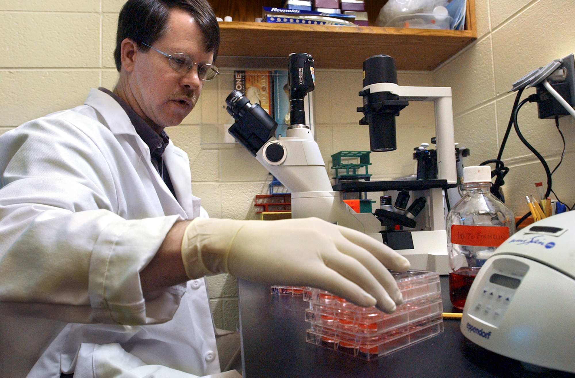 Monkeypox outbreak in US: What to know