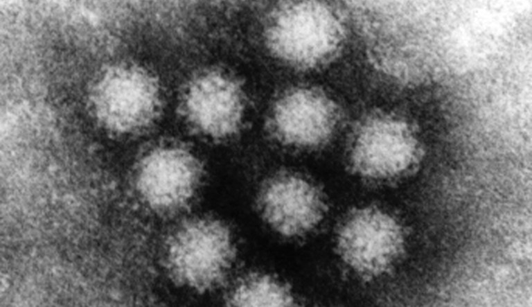 Norovirus outbreak in Louisiana casino leaves 200 ill