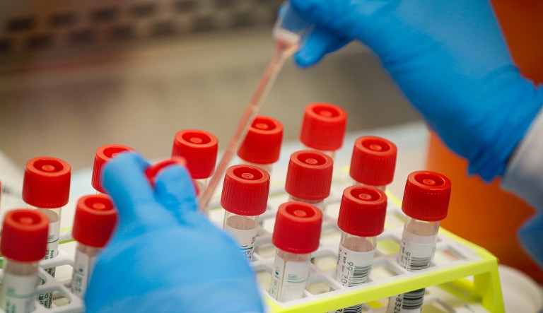 US single-day coronavirus death toll surpasses 100 for first time since outbreak began