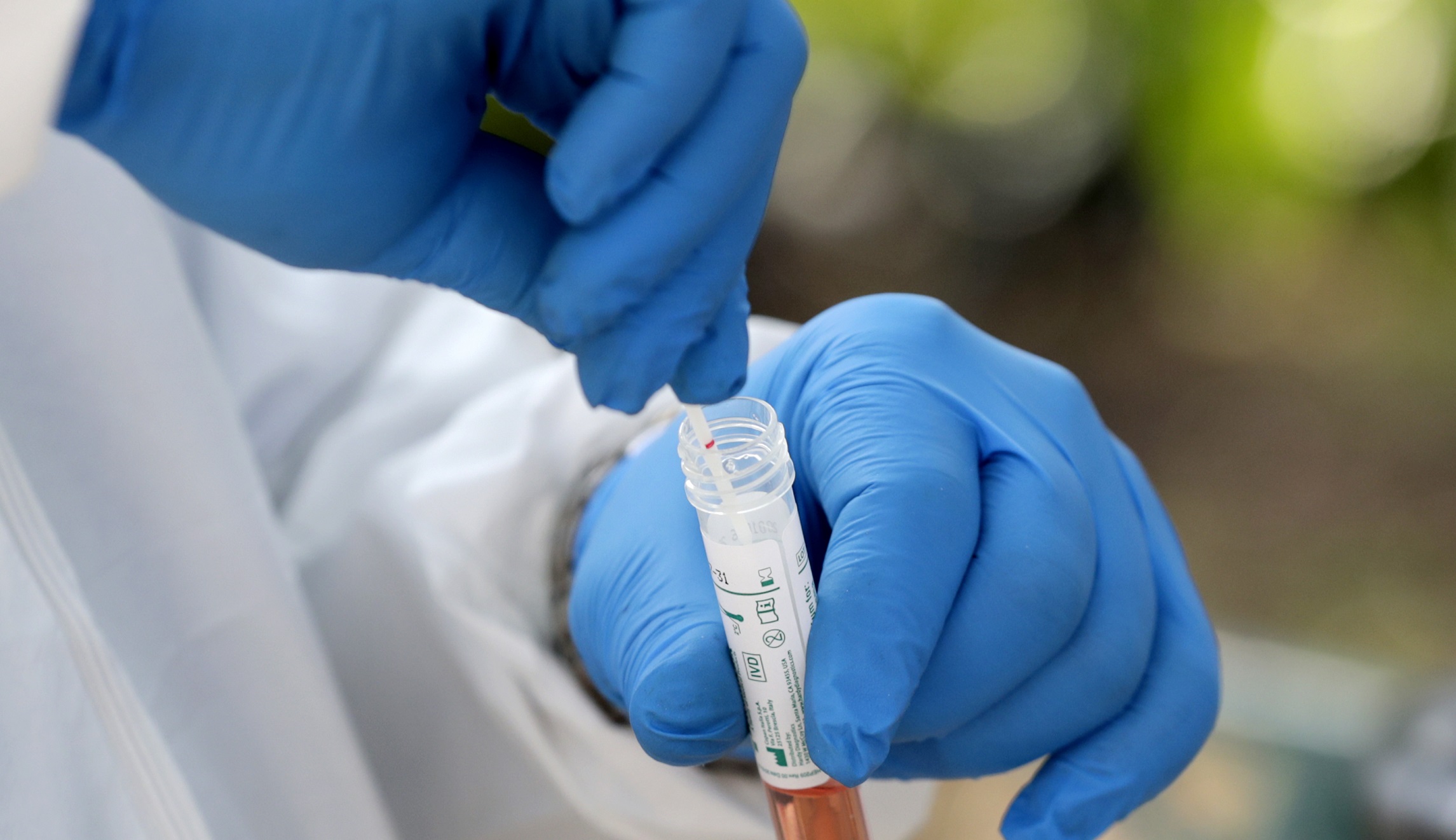 Trump opposition to coronavirus testing is reckless