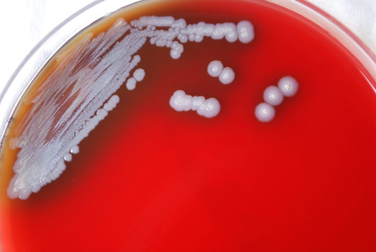 CDC identifies possibly deadly bacterium for the first time in US