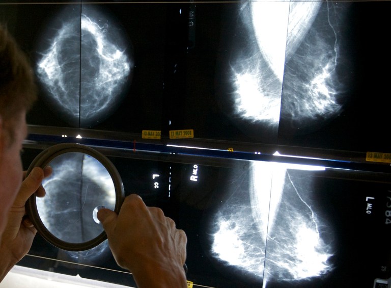 Task force proposes lowering mammogram starting age to 40