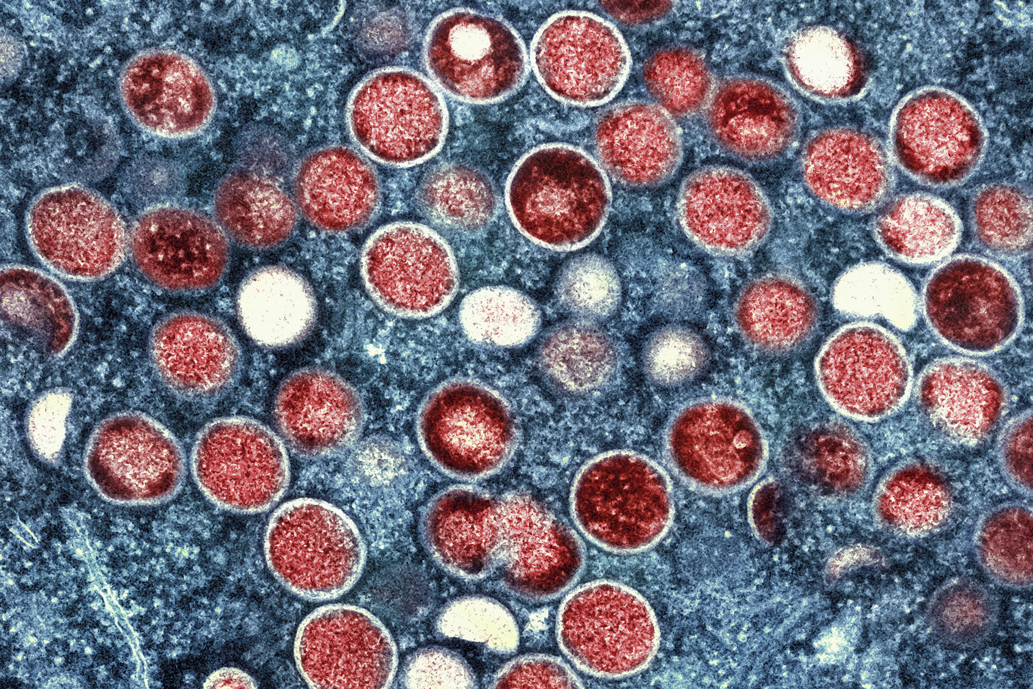 WHO and CDC concerned about deadlier strain of mpox