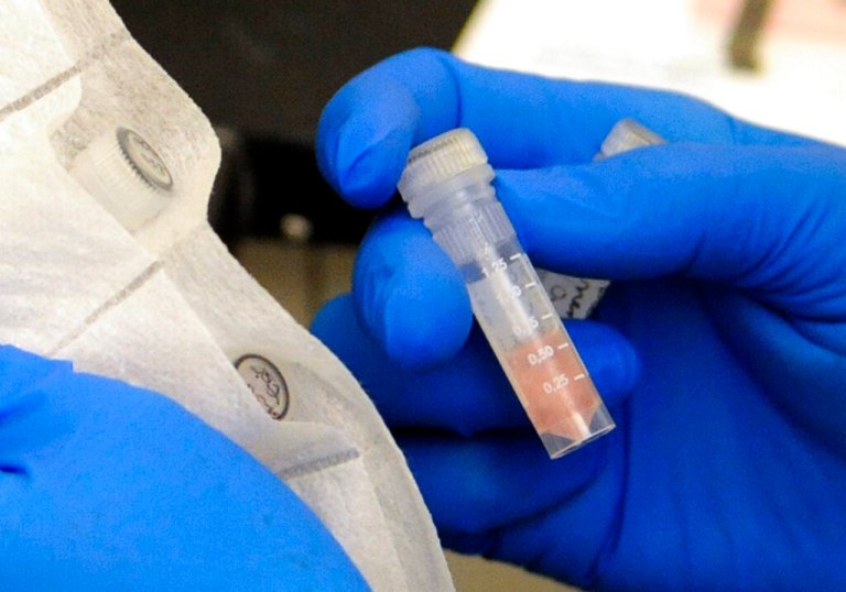 Rare fungal outbreak in Michigan suspected to affect nearly 100 paper mill workers