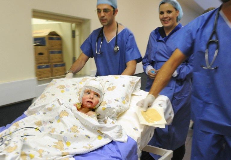   A 3-year-old girl Isabella Kruger, foreground, is taken to a theatre by Dr Hizir Mukaddam, left, and her mother Anice Kruger, second from right, for a unique skin transplant operation at Garden City Hospital in Johannesburg, South Africa, Monday, June 11, 2012. Kruger, who suffered severe burns over 80 percent of her body after an accident at a family barbecue has successfully undergone a rare surgery in Africa that gave her a new layer of cloned skin, her surgeon said Tuesday, June 12, 2012. (AP Photo/Antoine de Ras) SOUTH AFRICA OUT  