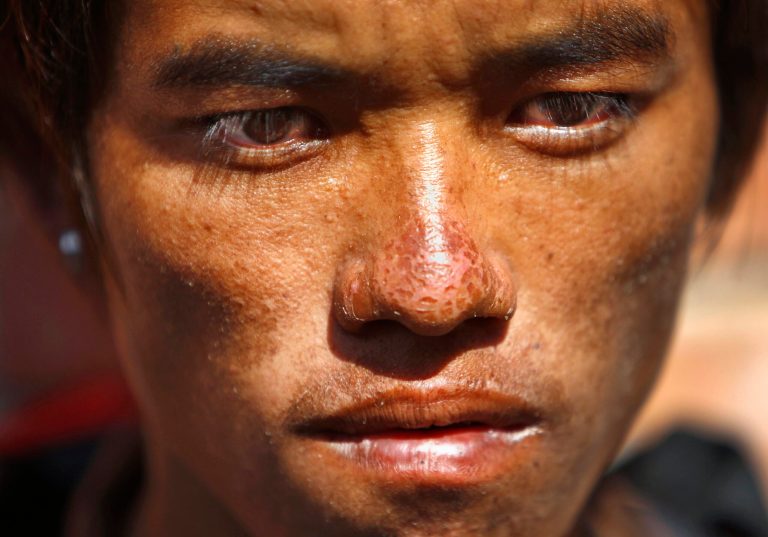 Sete Tamang, 20, avalanche survivor, waits to receive the bodies of his colleagues outside a morgue at Teaching Hospital in Katmandu, Nepal, Monday, Oct. 20, 2014. Nepal was wrapping up rescue operations in its northern mountains Monday, saying all the hikers believed to have been stranded on a trekking route by a series of deadly blizzards are now safe. (AP Photo/Niranjan Shrestha)