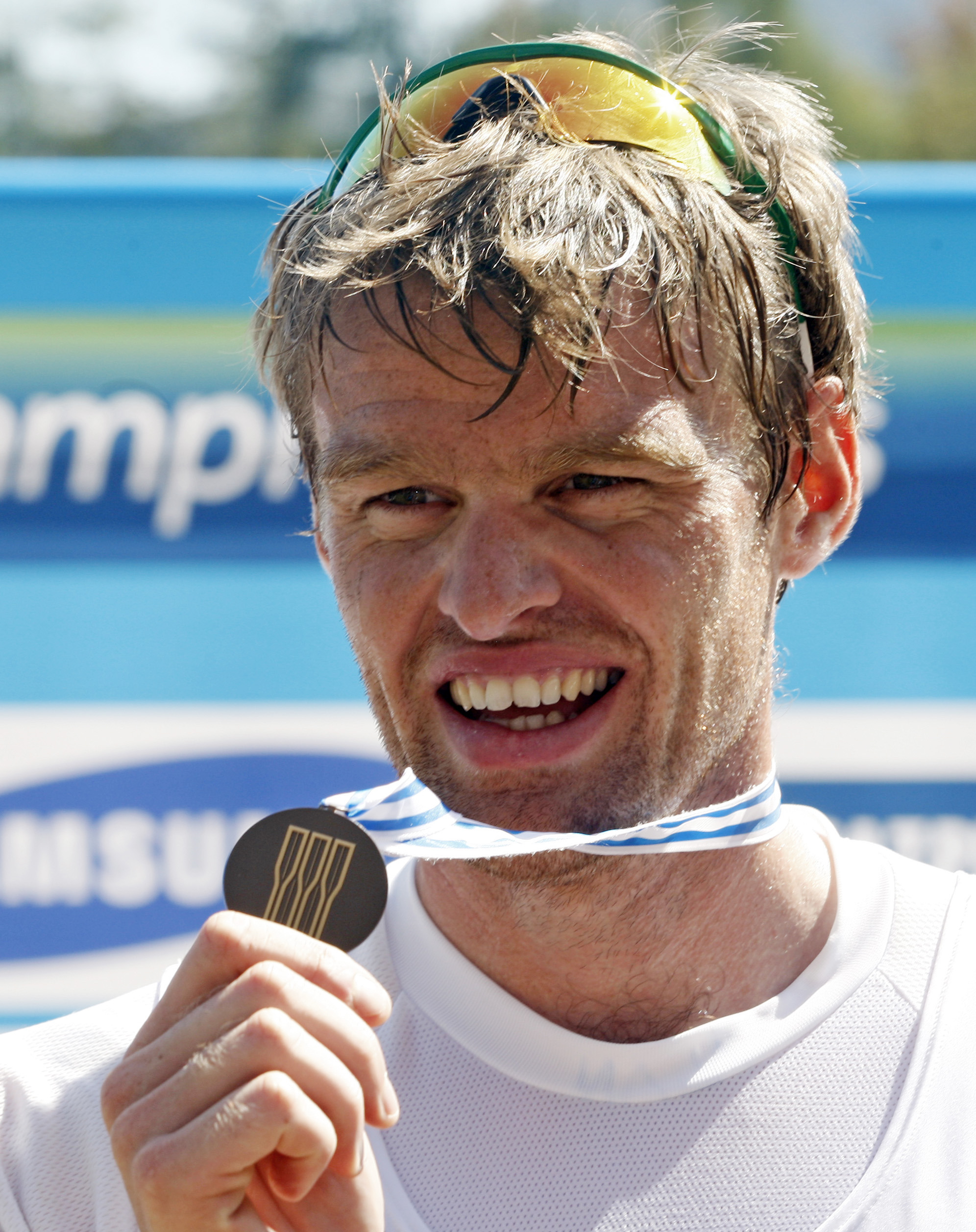 The paradox of Olympians’ “garbage” teeth