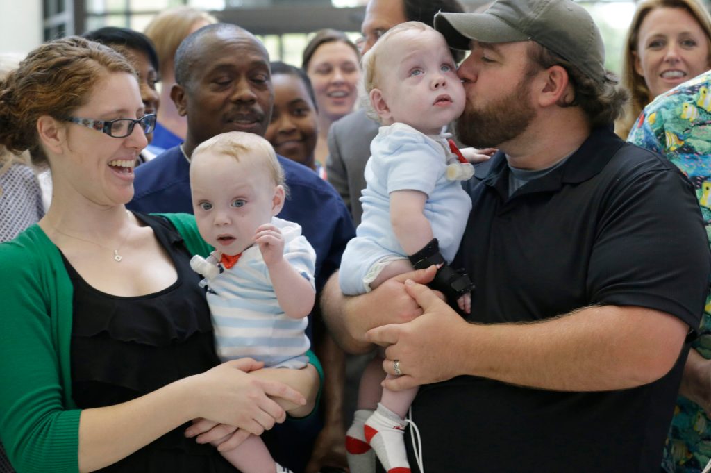 Formerly conjoined twins celebrate first birthday