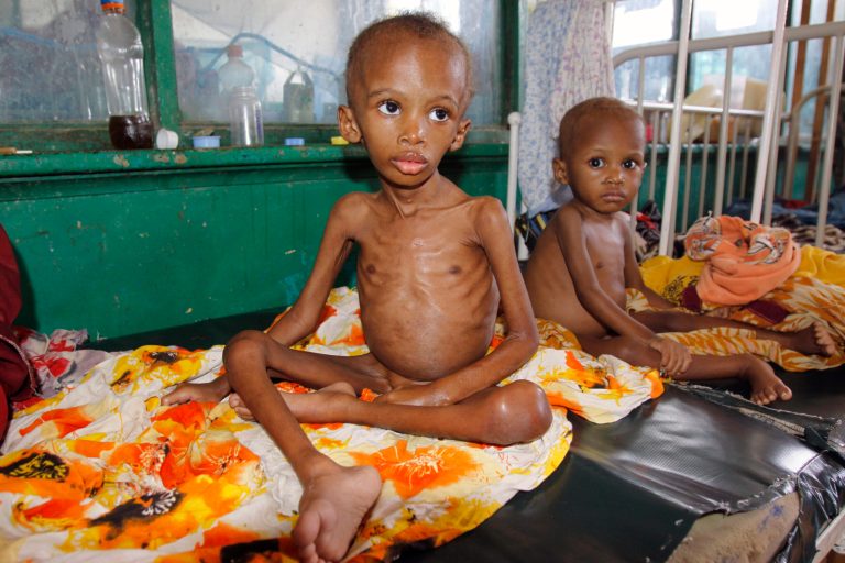 Malnourished children sit on a bed at Banadir Hospital,  in Mogadishu, Somalia, Wednesday, May 7, 2014. Aid groups in Somalia are warning that seasonal rains are failing and mass hunger could again descend on the country. The U.N.'s food and security unit says 51,000 children are severely malnourished and are at high risk of death. Aid groups said Wednesday that despite such a grim number only 12 per cent of the needed aid funds in 2014 have been met. Aid groups say an additional (Canadian) $822 million is needed. (AP Photo/Farah Abdi Warsameh)