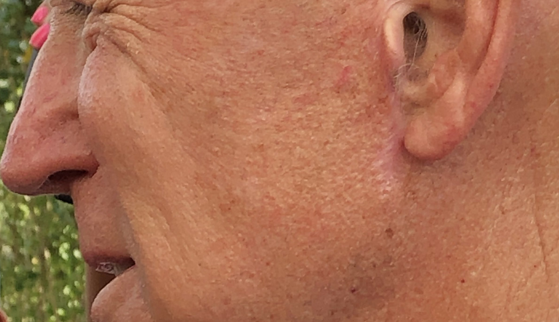 ‘It’s obvious’: Cosmetic surgeons say Biden had facelift before 2020 campaign