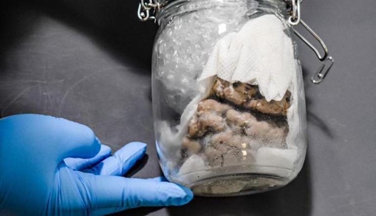 Jarred human brain found on Canadian mail truck: CBP