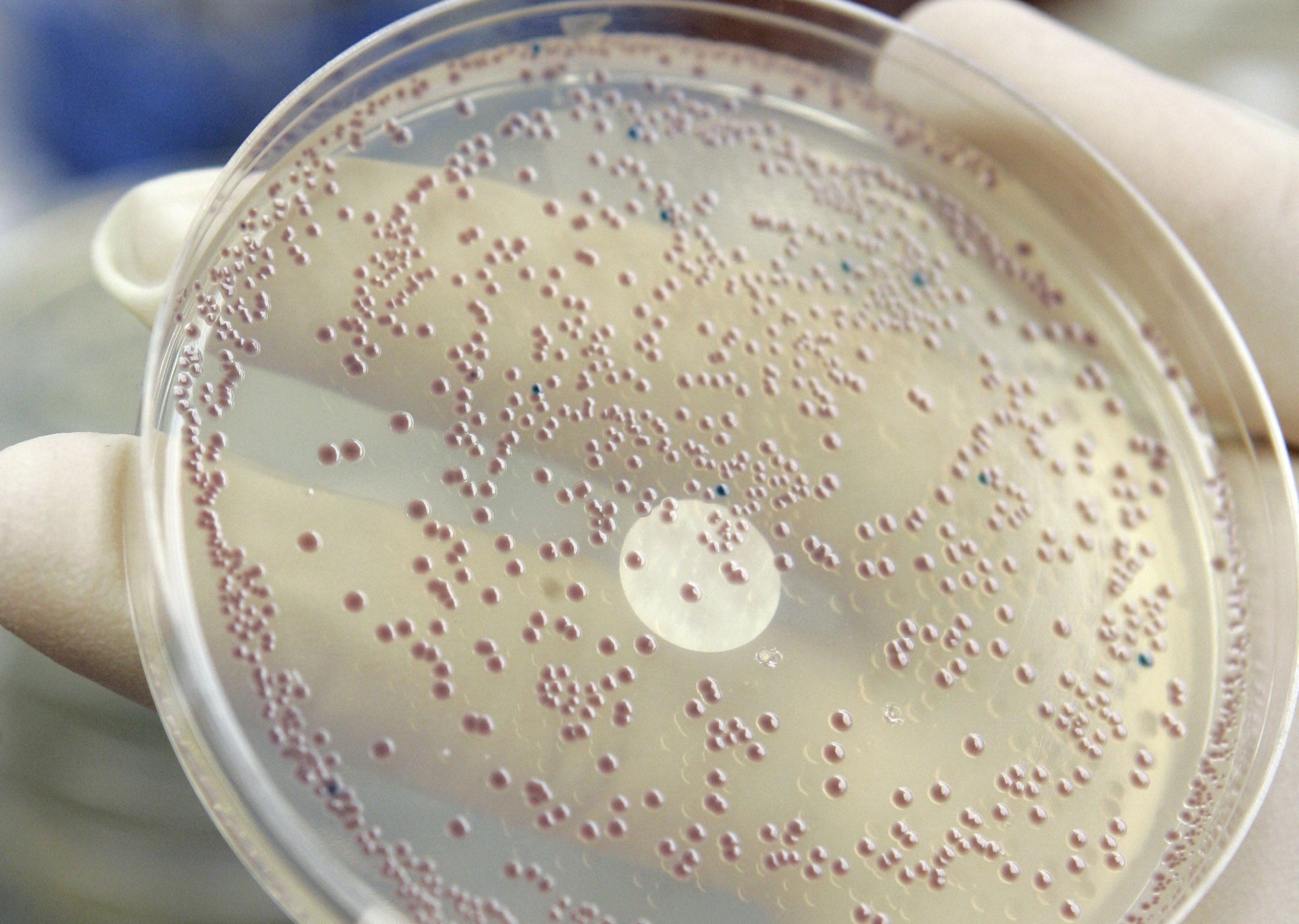 The next big thing in biofuels: E. coli