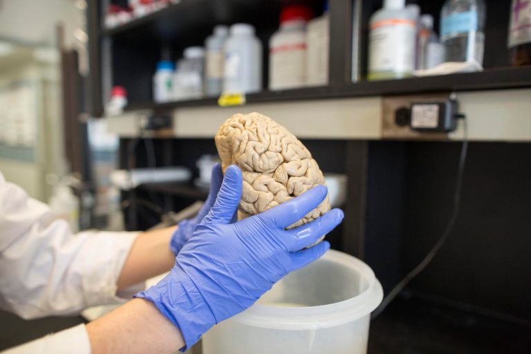 There is little research on the causes of AlzheimerÃ¢â¬â¢s, according to a recent report from the Food and Drug Administration. (AP file)