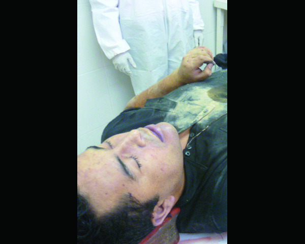This photo released by Mexico's Navy on Tuesday, Oct. 9, 2012 allegedly shows the body of Zeta drug cartel leader and founder Heriberto Lazcano while in the possession of Mexico's Medical Forensic Service (SEMEFO) in Sabinas, Mexico. Mexico's Navy says fingerprints confirm that cartel leader Lazcano, an army special forces deserter whose brutal paramilitary tactics helped define the devastating six-year war among Mexico's drug gangs and authorities, was killed Sunday in a firefight with marines in the northern state of Coahuila on the border with the Texas. (AP Photo/Mexico Navy)
