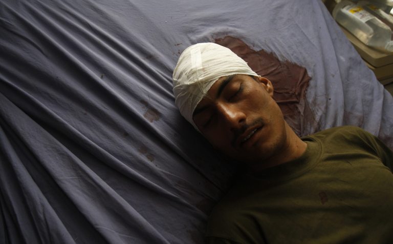   Pakistani tribal policeman Amanullah Khan, receives treatment at a local hospital in Peshawar, Pakistan, Sunday, Dec. 30, 2012. Twenty-one tribal policemen who were shot dead were found by officials shortly after midnight Sunday in the Jabai area of Frontier Region Peshawar after being notified by one policeman who escaped, said Naveed Akbar Khan, a top political official in the area. Another policeman was found seriously wounded, said Khan. (AP Photo/Mohammad Sajjad)  